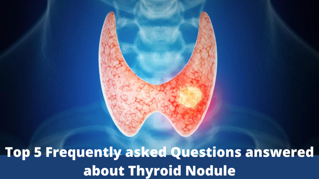 specialist for thyroid 