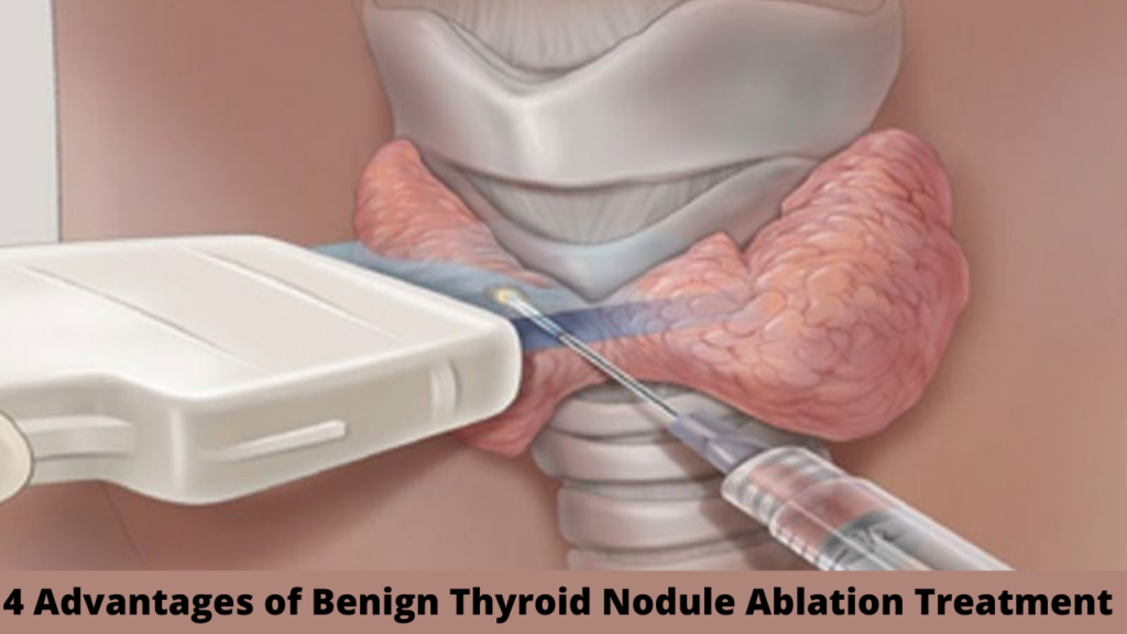 thyroid treatment in hyderabad