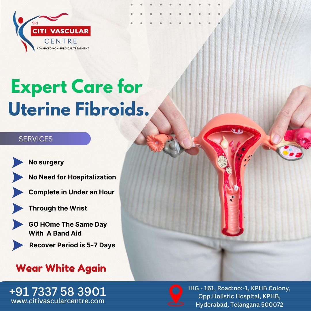 best fibroid treatment in Hyderabad