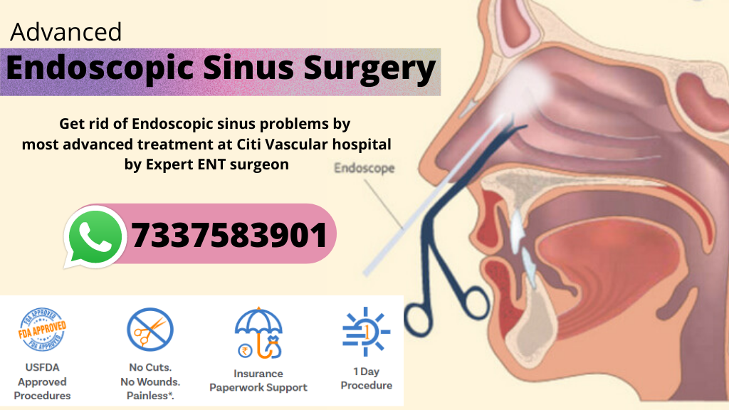 endoscopic sinus surgery cost in Hyderabad
