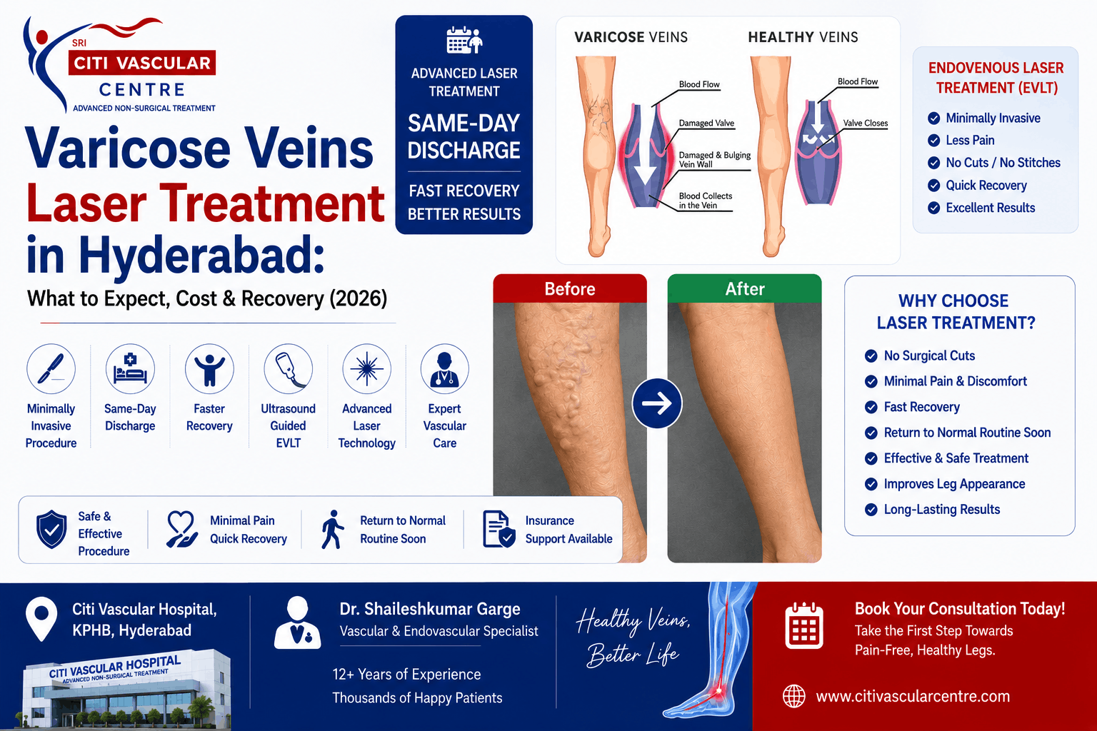Laser treatment varicose veins Hyderabad  
EVLT laser treatment Hyderabad, 
varicose veins laser procedure Hyderabad
ultrasound guided EVLT Hyderabad
laser treatment for leg veins Hyderabad
