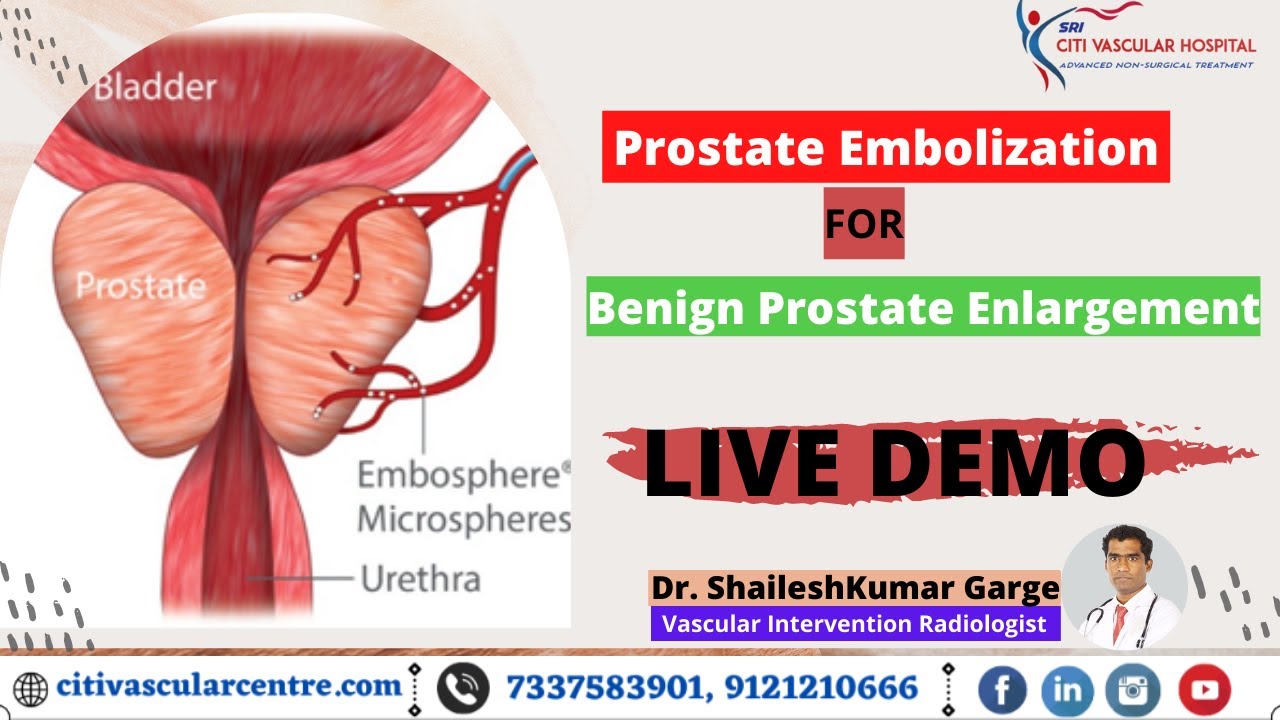 best doctor for prostate in hyderabad