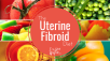 treatment for fibroids in hyderabad 