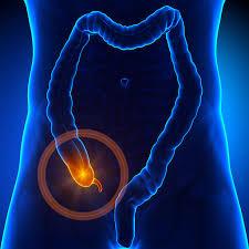 best treatment for appendix in hyderabad