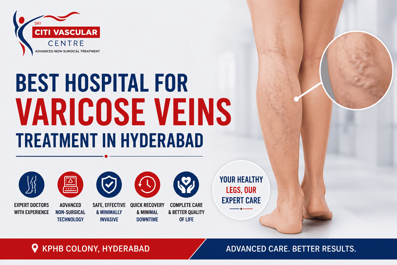 best hospital for varicose veins treatment in Hyderabad