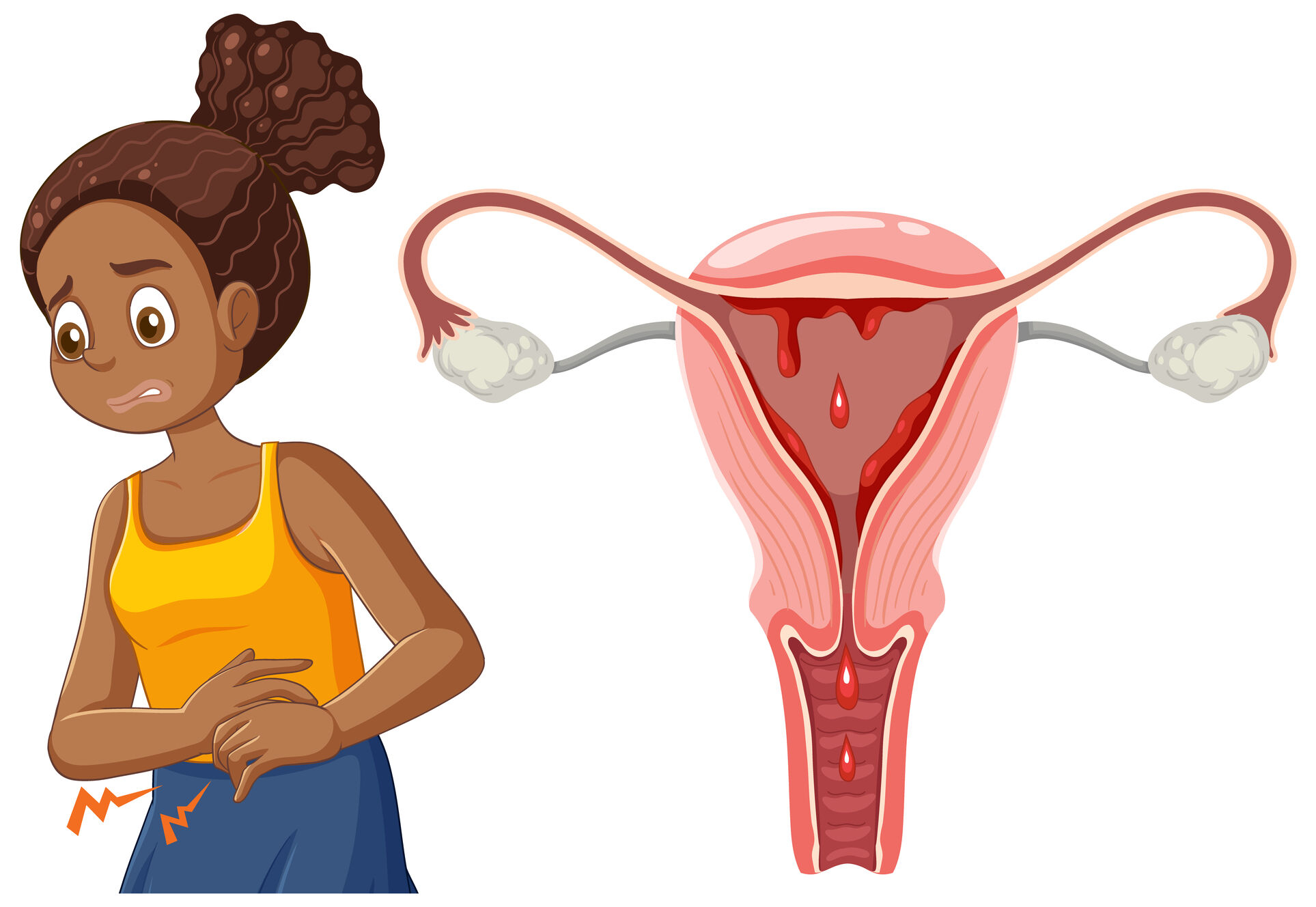 Fibroid specialist in Hyderabad