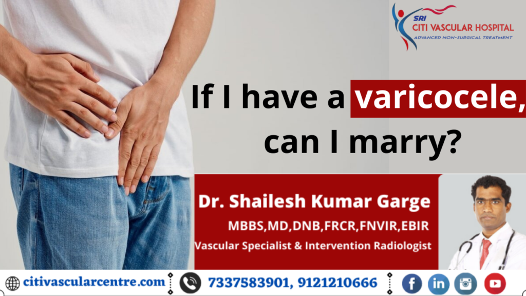 best treatment for varicocele in hyderabad