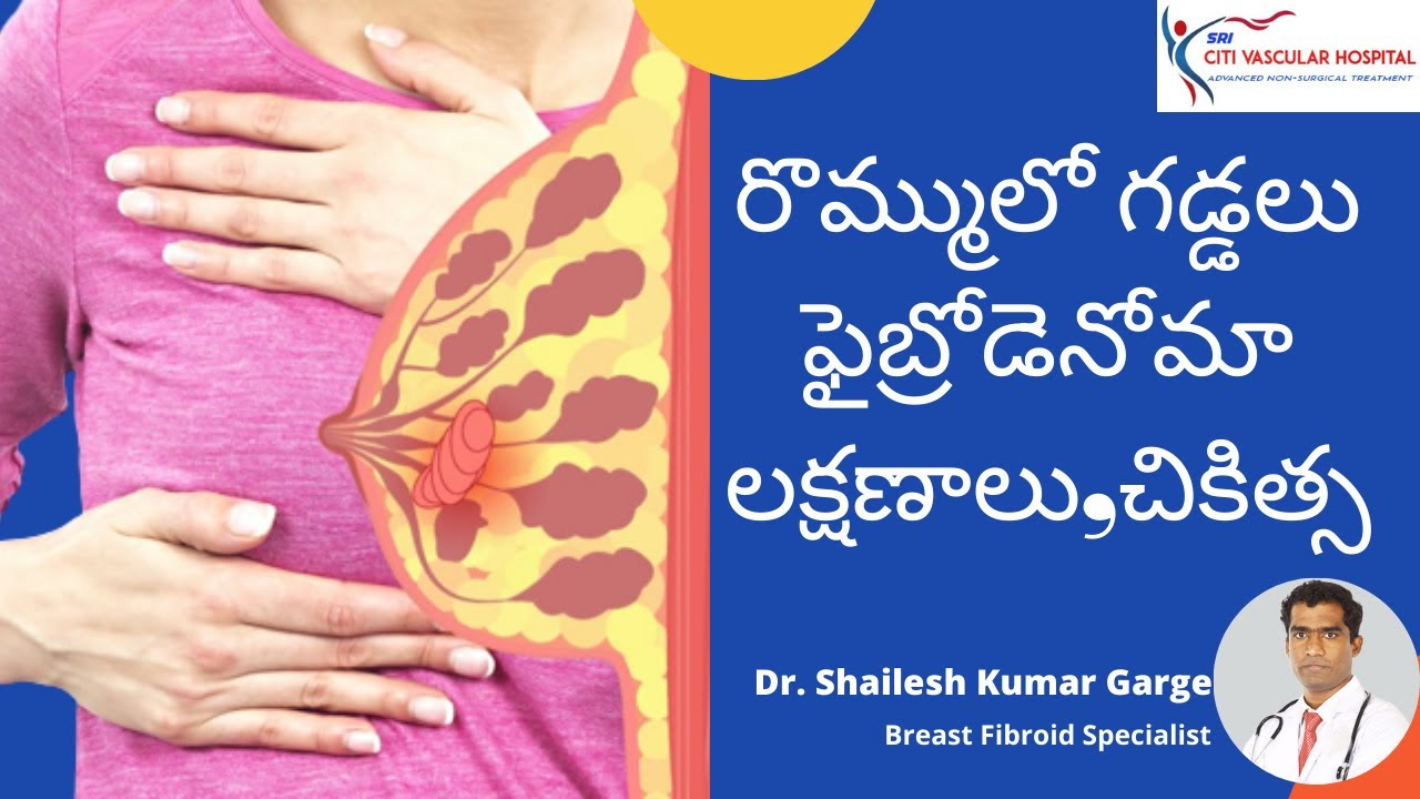 best treatment for breat fibroidenoma in hyderabad
