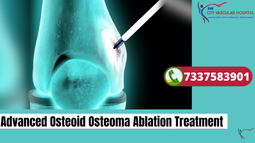 advanced osteoid osteoma ablation treatment in hyderabad