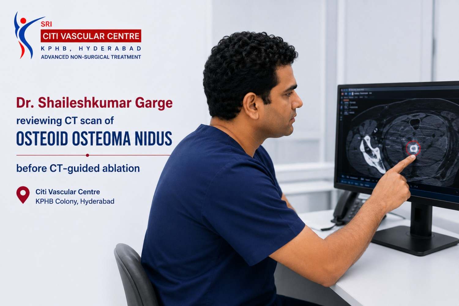 Dr. Shaileshkumar Garge reviewing CT scan of osteoid osteoma nidus before CT-guided ablation at Citi Vascular Centre KPHB Colony Hyderabad
