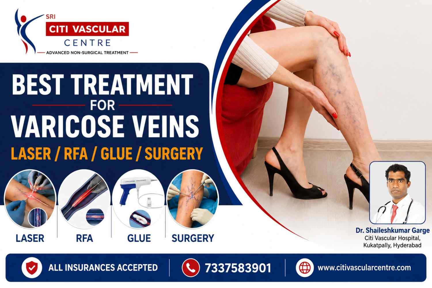 Side-by-side comparison chart of varicose vein surgery versus EVLT laser versus RFA versus VenaSeal glue treatment showing recovery times success rates and patient outcomes Hyderabad 2026