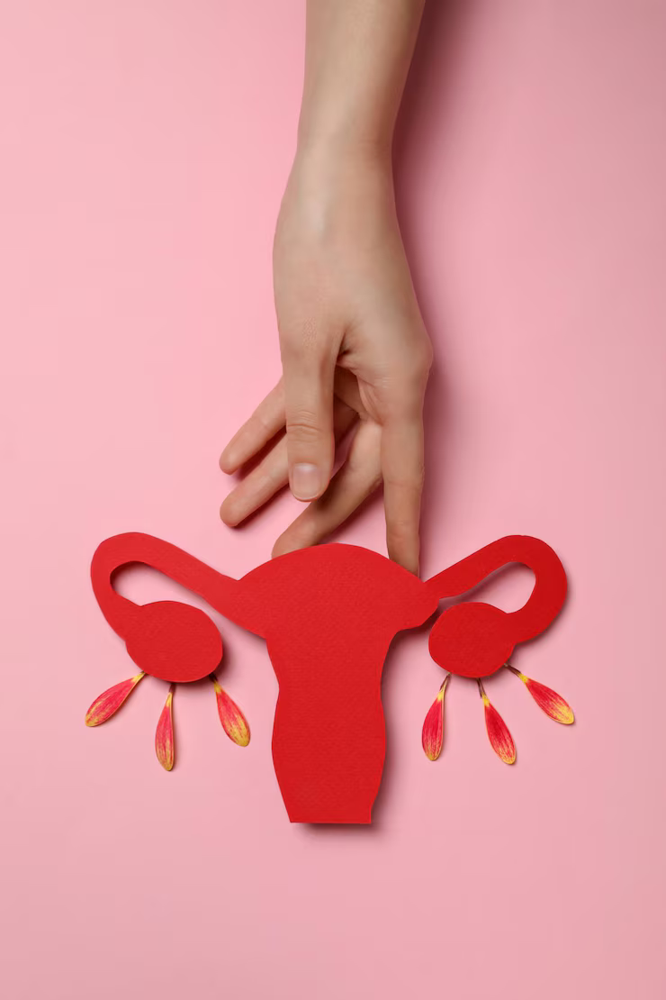 UFE treatment for fibroids in Hyderabad