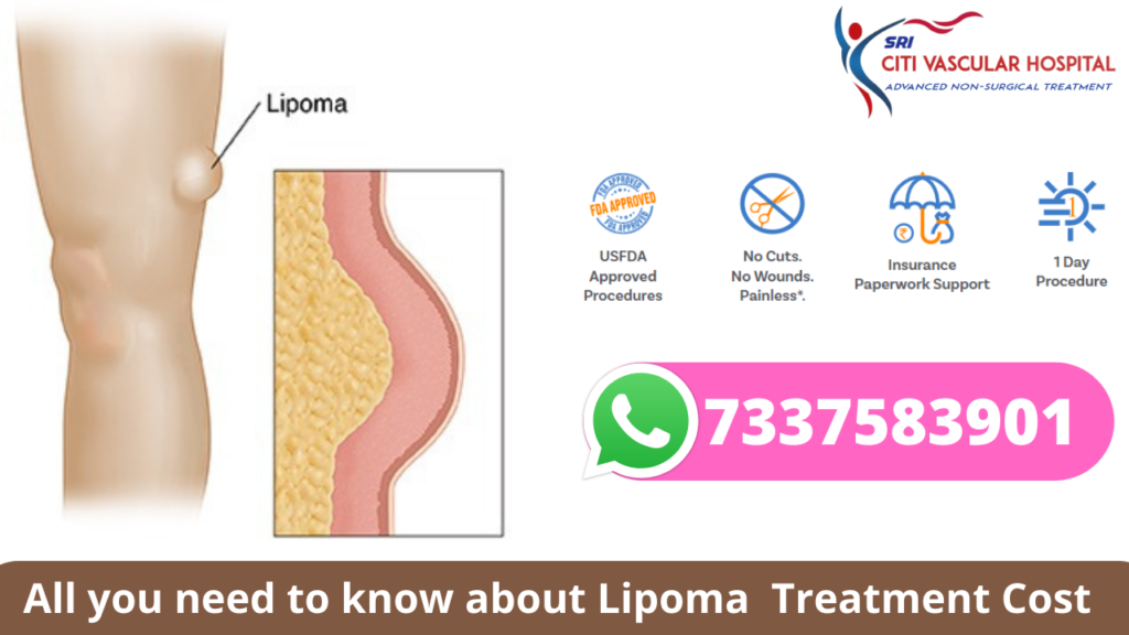best hospital for lipoma in hyderabad