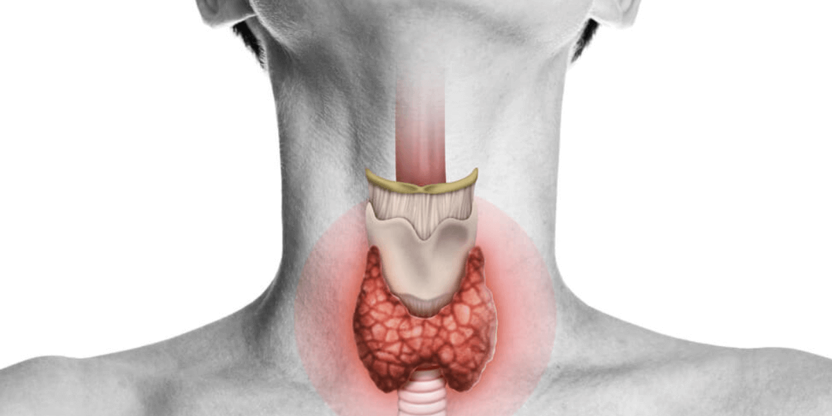 thyroid treatment in citi vascular centre