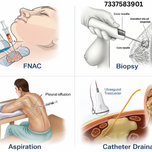 fnac biopsy cost in hyderabad