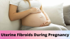 best doctor for fibroid in hyderabad