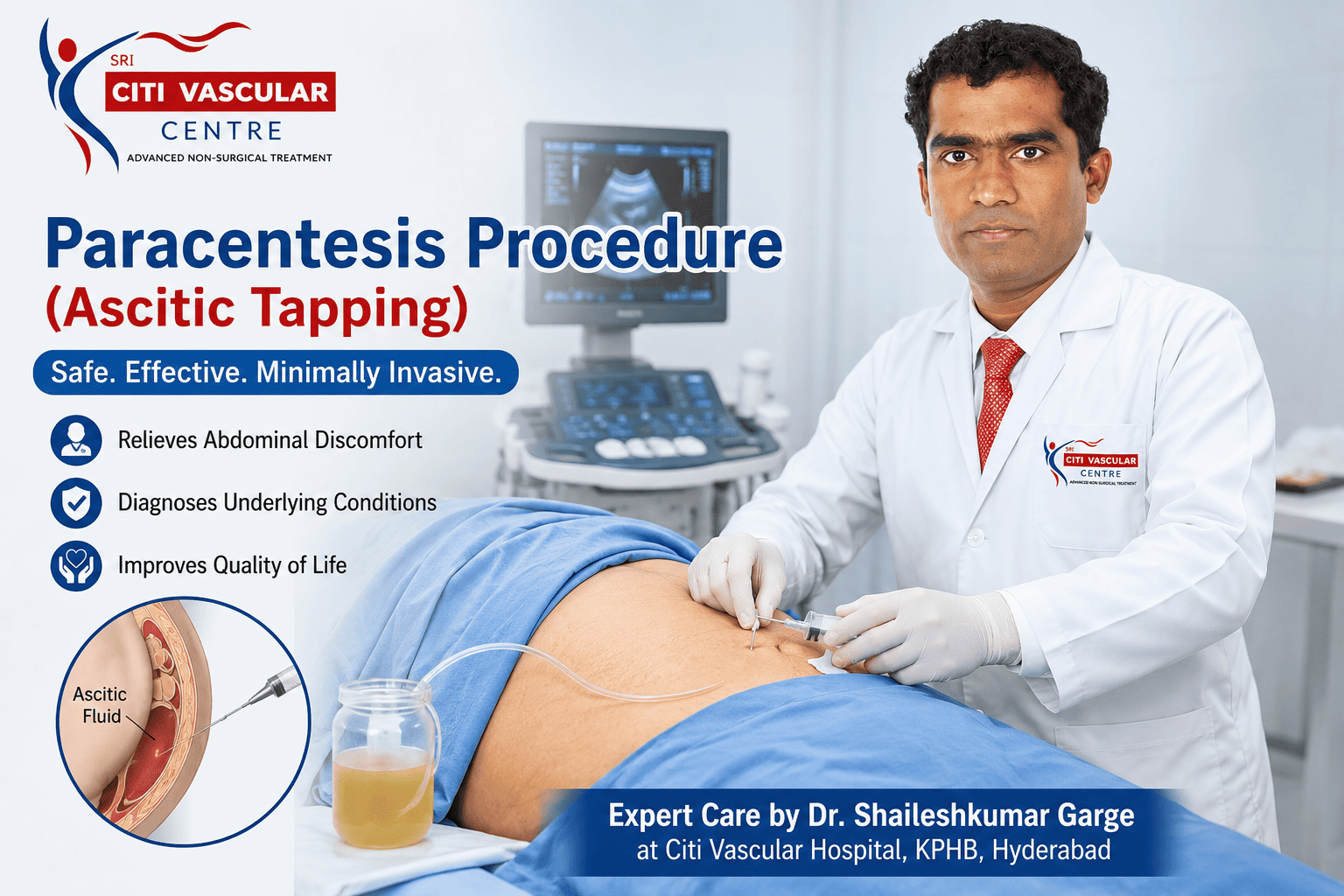 Doctor performing paracentesis procedure for ascites patient at Citi Vascular Hospital Hyderabad 
