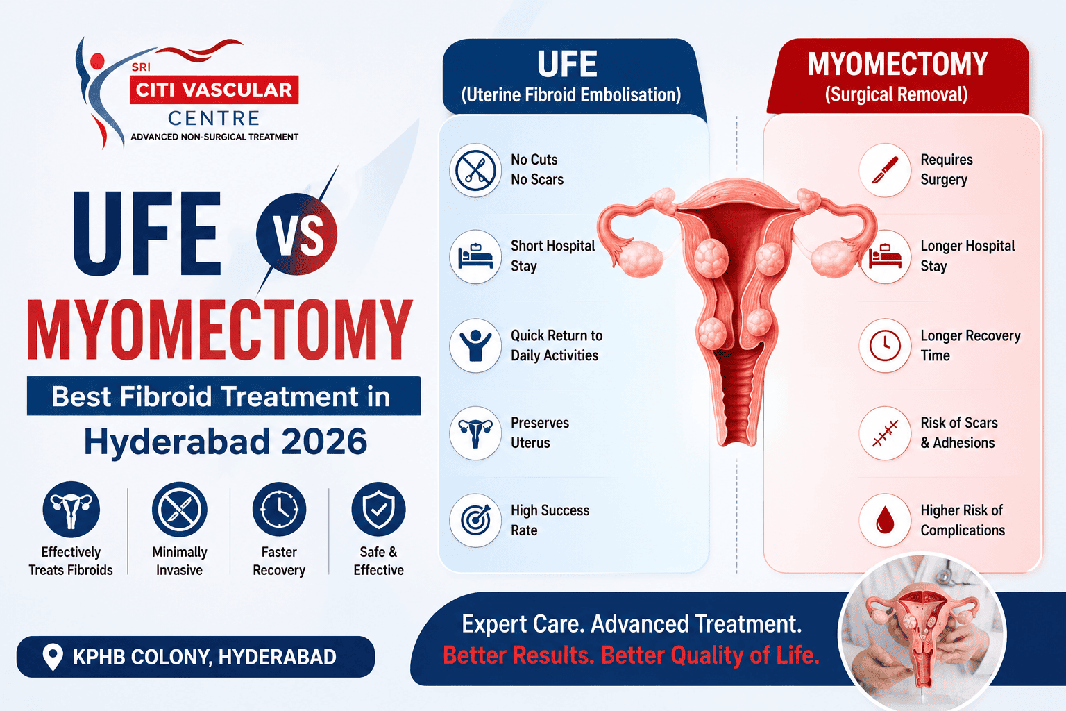 best fibroid treatment in Hyderabad