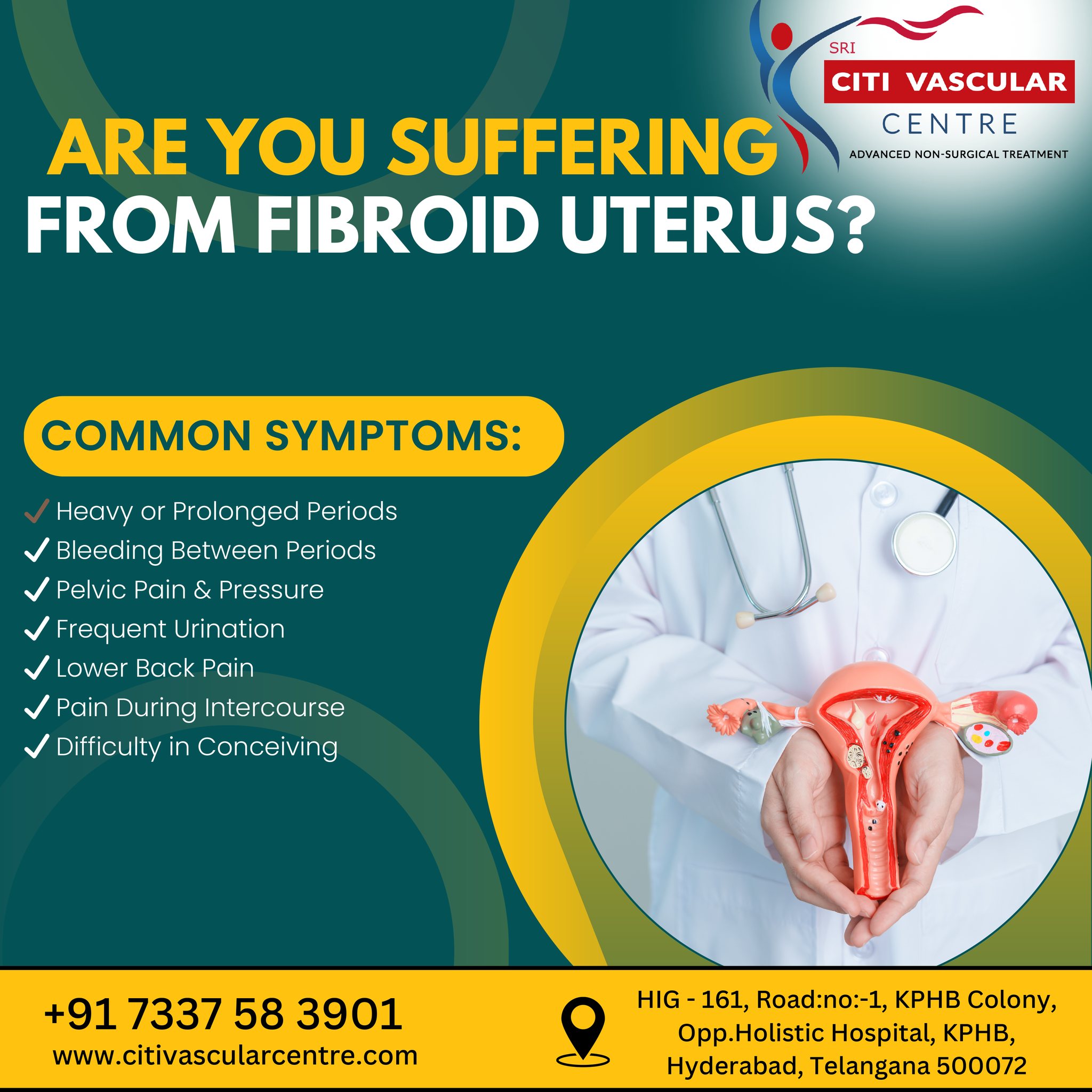 exercises for fibroids