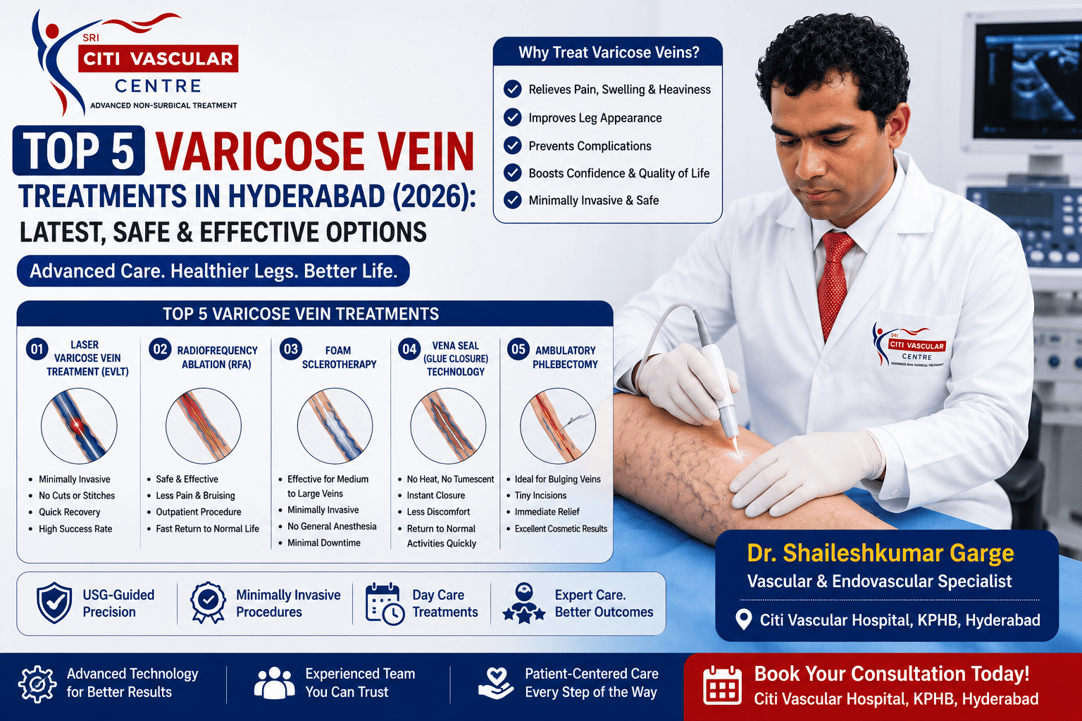best varicose vein treatment hyderabad