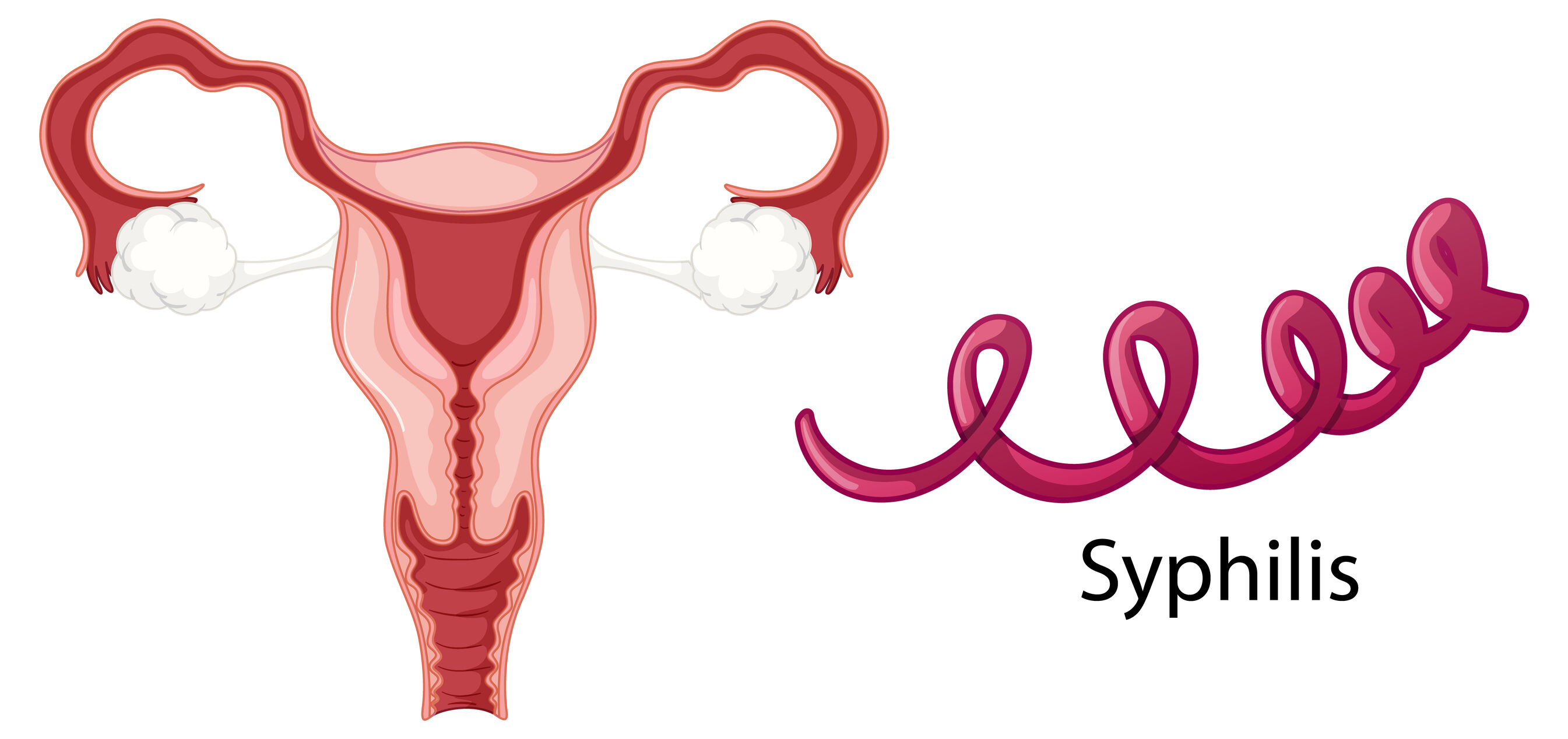 diet for uterine fibroids Hyderabad