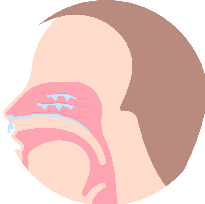 septoplasty surgery cost in hyderabad