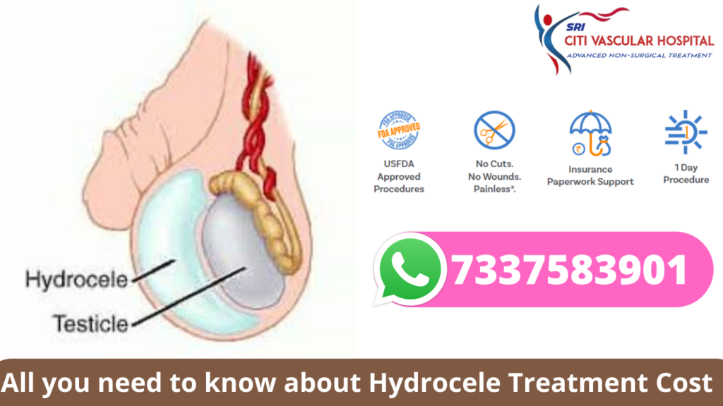Hydrocele Treatment Cost